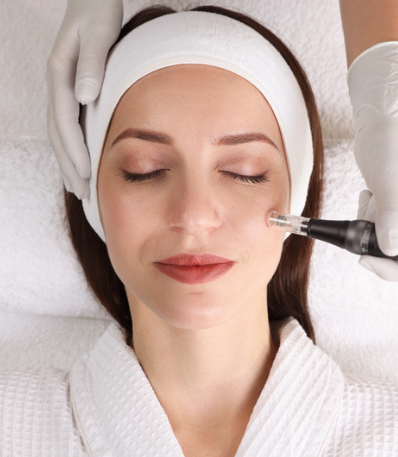 Microneedling